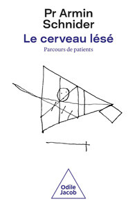 16759495260_Le-Cerveau-lese.jpg